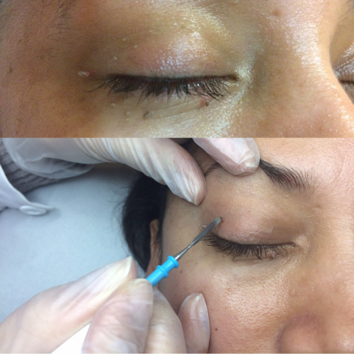 Foto Cl�nicas DH - Medicina Est�tica Avanzada